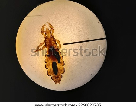 a sample of head lice when viewed under a microscope