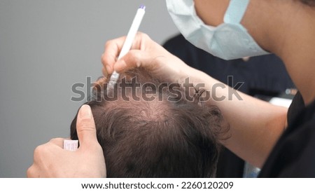 doctor check before hair transplant Royalty-Free Stock Photo #2260120209