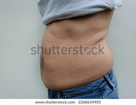 Close-up of Asian woman is beside big belly. Wearing a white shirt. a lot of excess fat. Seeing the fat groove until the belly sags. Dimpled navel. Stomach ache and weight loss, care, healthy concept