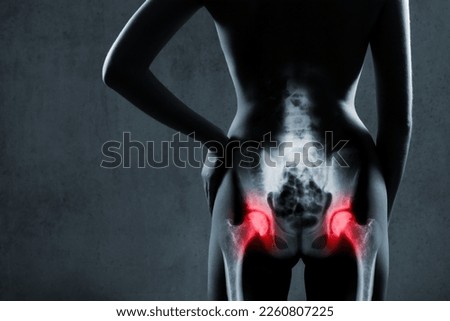 Human hip joint in x-ray on gray background. Painful hip joints is highlighted by red color. X-ray image of painful hips in woman. Osteoarthritis hip joints at red area mark. Royalty-Free Stock Photo #2260807225
