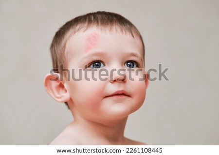 Toddler baby face with scratch on forehead. Portrait of a baby boy with a head injury. Kid aged one year six months Royalty-Free Stock Photo #2261108445