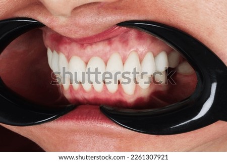 Caucasian male open mouth showing row of white teeth and back of the throat. Close up macro shot, unrecognizable face. High quality photo
