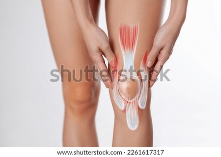 Knee ligament and meniscus, human leg, medically accurate representation of an arthritic knee joint Royalty-Free Stock Photo #2261617317