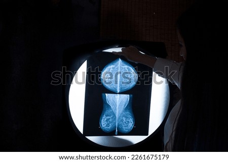 Female Doctor with specialty in Gynecology analyzes x-rays of patient's mastography to provide an explanation and report on health status Royalty-Free Stock Photo #2261675179