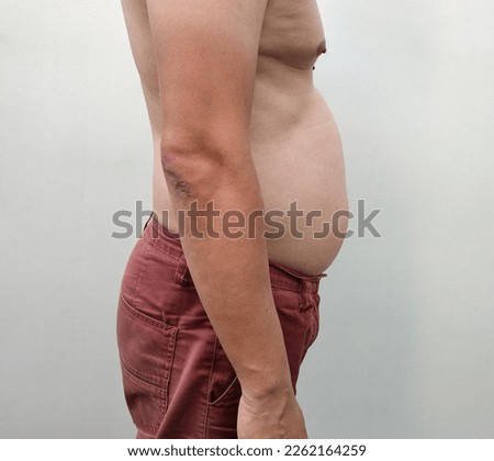 Close-up of Asian man is beside big belly. Shirtless, waering brown pants. excess fat. Seeing the fat groove until the belly sags. Dimpled navel. Stomach ache and weight loss, care, healthy concept