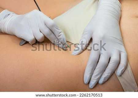 Electrolysis professional hair removal in bikini zone, cosmetologist hands in gloves work on female skin close up