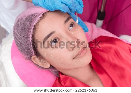An Esthetician applying numbing cream or local anesthetic to small moles or warts on a patient's face with a cotton swab before electrocautery procedure at an aesthetic center and dermatology clinic.