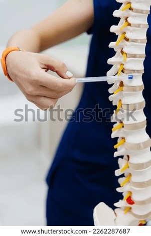 The doctor shows an intervertebral hernia on the spine at the table.