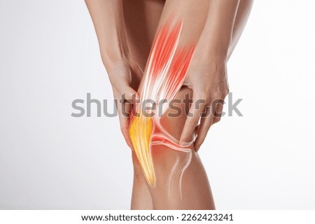 Knee ligament and meniscus, human leg, medically accurate representation of an arthritic knee joint Royalty-Free Stock Photo #2262423241