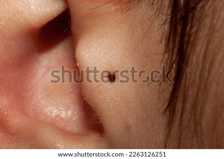 Fully healed ear cartilage tragus piercing without jewelry. Photo of the piercing channel (hole). Close-up macro photo. Royalty-Free Stock Photo #2263126251