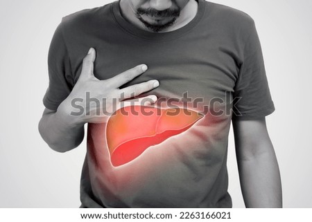 Asia men with hepatitis and fatty liver problem. The illustration of liver is on the man's body against gray background. Royalty-Free Stock Photo #2263166021