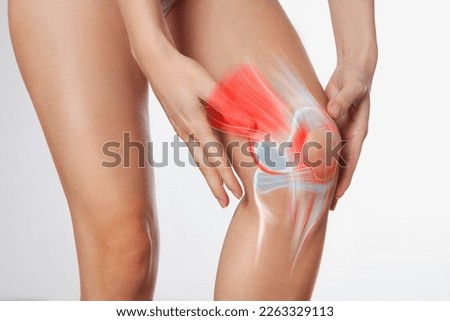 Knee meniscus inflamed, human leg, medically accurate representation of an arthritic knee joint	 Royalty-Free Stock Photo #2263329113