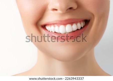 Perfect white teeth smile of a young woman. The result of the teeth whitening procedure. The image symbolizes oral care dentistry, Closeup on a white background. Royalty-Free Stock Photo #2263943337