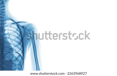X-ray images of the shoulder  for medical diagnosis.