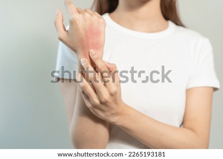 Dermatology asian young woman allergy, allergic reaction from atopic, insect bite, scratching itchy back of hand, red spot or rash of skin. Healthcare treatment of beauty. Isolated on white background Royalty-Free Stock Photo #2265193181
