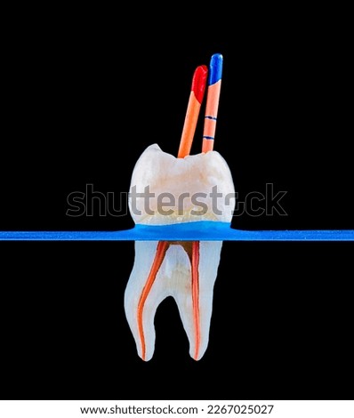 tooth slice macro capture during root canal treatment Royalty-Free Stock Photo #2267025027