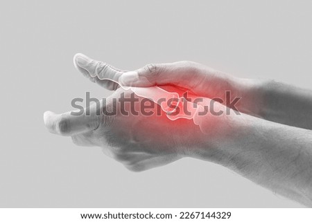 Arthritis of the finger and thumb joint. Royalty-Free Stock Photo #2267144329