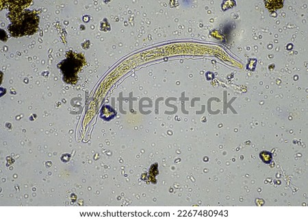 soil microorganisms including nematode, microarthropods, micro arthropod, tardigrade, and rotifers a soil sample, soil fungus and bacteria on a regenerative farm in compost under the microscope. Royalty-Free Stock Photo #2267480943