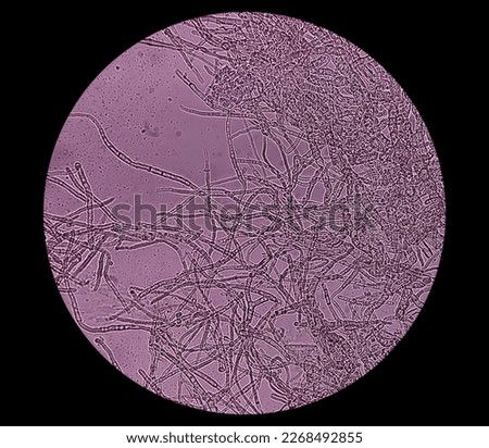 Microscopic fungi Malassezia furfur, showing yeast cells and hyphae. dermatophytes, Nail scraping or skin scraping for fungus test in microbiology laboratory. Royalty-Free Stock Photo #2268492855