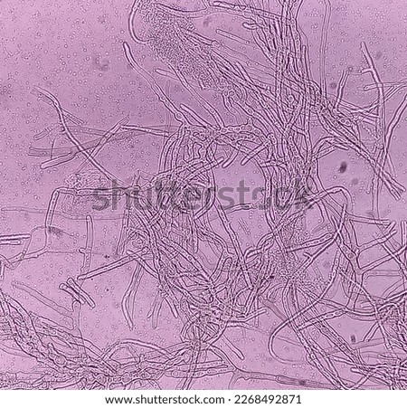 Microscopic fungi Malassezia furfur, showing yeast cells and hyphae. dermatophytes, Nail scraping or skin scraping for fungus test in microbiology laboratory. Royalty-Free Stock Photo #2268492871