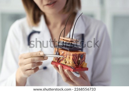Close-up of female dermatologist holding artificial model of human skin with hair. Doctor showing skin diseases and hair loss symptoms Royalty-Free Stock Photo #2268556733