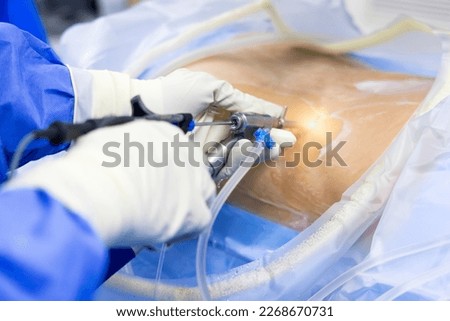 Selective focus with blur background.Surgeon picking up surgical instruments for doctor inside operating room in hospital.Doctor in blue uniform does minimal invasive endoscopic keyhole spine surgery. Royalty-Free Stock Photo #2268670731