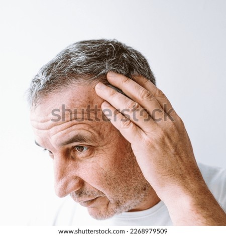 Middle-aged man demonstrates gray hair, hair loss problem, close-up. face of brown-eyed man, with facial wrinkles, age spots on skin, shows gray hair on head Royalty-Free Stock Photo #2268979509