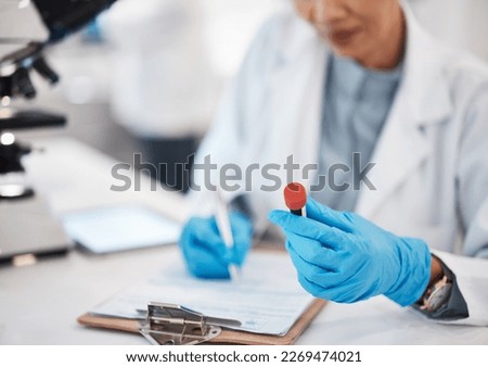 Scientist, woman and writing lab results with study, focus or analysis for pharma development. Science expert, checklist and documents with microscope, innovation and report of pharmaceutical trial Royalty-Free Stock Photo #2269474021