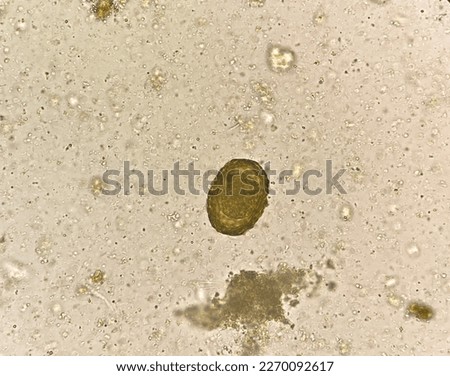 Ascaris lumbricoides  egg human parasite in stool examination.