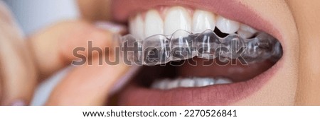 Clear Aligner Dental Night Guard For Teeth Royalty-Free Stock Photo #2270526841