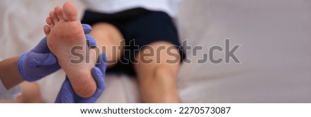 Infectious disease doctor examining rash on skin of child feet closeup Royalty-Free Stock Photo #2270573087