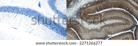 Cytoarchitectonics of the cerebellum. Histological sections are stained by the Nissl method (left) and by impregnation with silver nitrate (right). Royalty-Free Stock Photo #2271266277