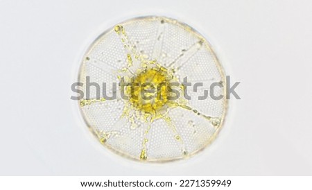Marine phytoplankton, Asteromphalus sp. Lugol fixed sample. 400x magnification. Selective focus Royalty-Free Stock Photo #2271359949
