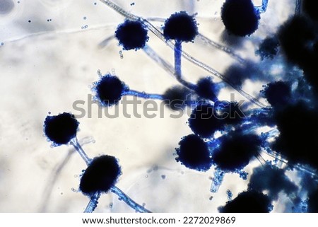 Microscope of black fungus spore strain with Lactophenol cotton blue, molds or yeasts with macro 40x lens, contamination in air room, pollution aerosol environmental. Microbiology laboratory concepts. Royalty-Free Stock Photo #2272029869