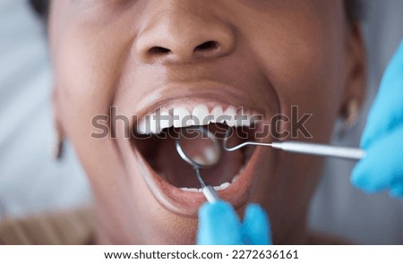 Checkup, teeth and woman with a dentist for oral hygiene, cavity check or cleaning mouth. Zoom, dental and doctor with mirror to look at the tooth of a girl for healthcare, treatment and examination Royalty-Free Stock Photo #2272636161