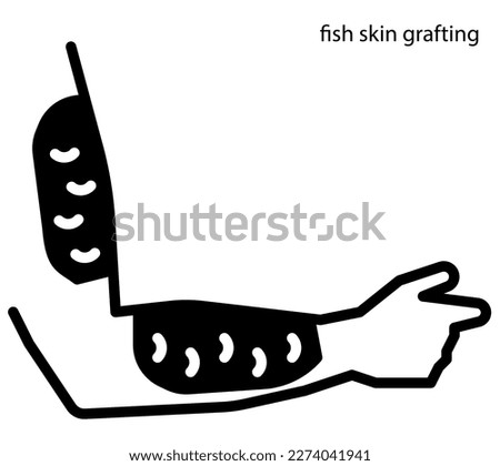 Fish skin grafting for wound healing Royalty-Free Stock Photo #2274041941