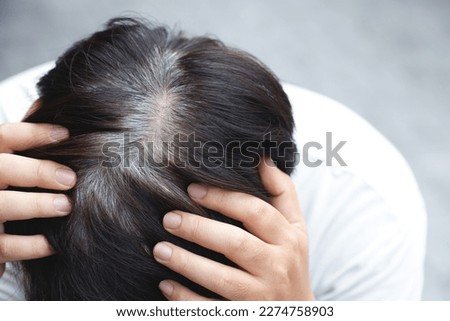 Back view of young people premature gray hair, showing black hoary hair roots on head change to senior old man outdoor. Royalty-Free Stock Photo #2274758903