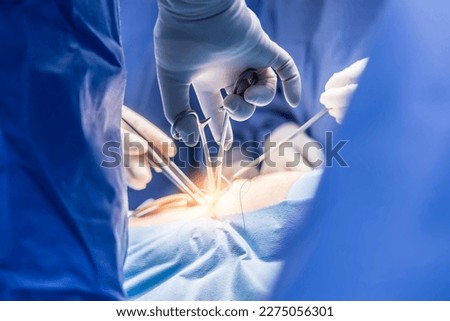Surgeon or doctor in blue uniform did surgery in surgical hospital with orange light effect and blur background. Surgeon and nurse use medical instrument or equipment in operating room.People working. Royalty-Free Stock Photo #2275056301