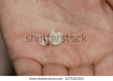 Milk tooth of an 11-year-old child that fall out naturally, close-up photo shoot in children's hand