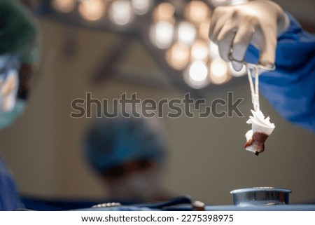 Hand of surgery doctor in Operating Room hold operating plier forceps tweezer pinch gauze and Dip piece of gauze into the solution wound healing potion in Operating theater.