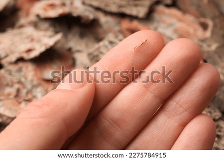 Woman with splinter in her finger on blurred background, closeup Royalty-Free Stock Photo #2275784915
