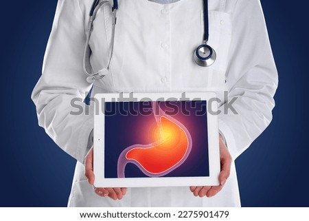 Treatment of heartburn and other gastrointestinal diseases. Doctor with tablet on dark blue background, closeup. Stomach illustration on screen Royalty-Free Stock Photo #2275901479