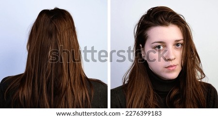 A young woman with dirty, oily and greasy hair on a gray background. Front and rear view. Royalty-Free Stock Photo #2276399183