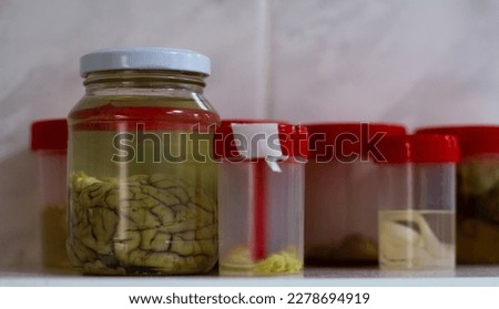 On the shelf are jars filled with formaldehyde with internal organs inside. The real mog is in a jar of formaldehyde. Samples of organs in formaldehyde for the study of anatomy. Royalty-Free Stock Photo #2278694919