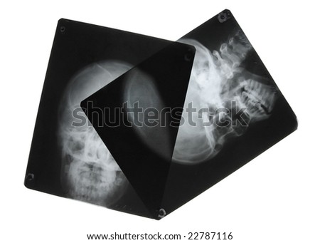 black and white photo of x-ray pictures of human skulls