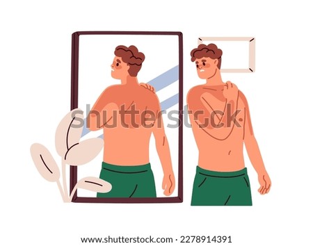Man with reddish body after sun UV, looking at skin sunburns in mirror. Suntan burns problem on body. Sad person with burnt spots. Flat graphic vector illustration isolated on white background Royalty-Free Stock Photo #2278914391