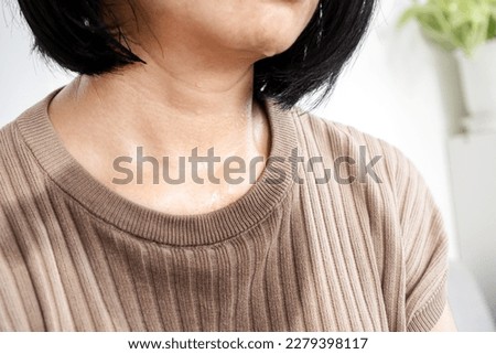 sweating woman with wet cloth feeling hot from weather in summer, heat stroke concept Royalty-Free Stock Photo #2279398117