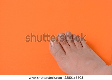 photo of foot with long thumb toe nail Royalty-Free Stock Photo #2280168803