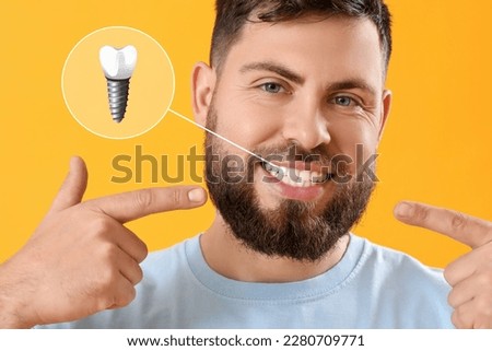 Young man with implanted teeth on yellow background Royalty-Free Stock Photo #2280709771