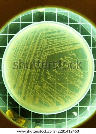 Growth of Cutibacterium acnes bacteria on the media